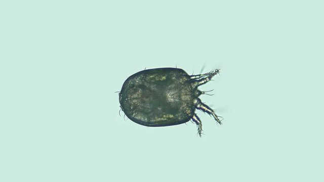Acari (mite) Deutonymph under the microscope, of the Histiostomatidae family. It feeds on bacteria. Looks like a parasite. Fastened to insects for settling in favorable living conditions