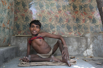 Portrait of a man living with disabilities on the streets of Delhi.