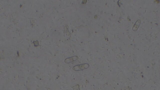 Microscopy of Coccidia organisms in a rabbit feces. Parasite (Eimeria species) in a form of Oocysts. These organisms live in rabbit intestines and can infect the liver. 