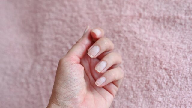 Woman hand with thin square shaped nails damaged after poor quality hardware manicure on pink fabric background extreme closeup