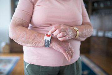 Senior woman using alert bracelet, Sweden