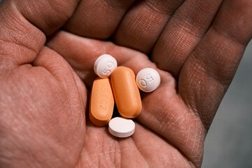 white and orange antiretroviral therapy pills for treatment of HIV in hand. Dolutegravir, Abacavir,...