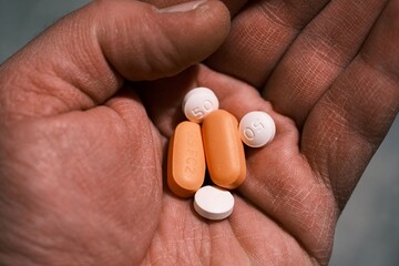 white and orange antiretroviral therapy pills for treatment of HIV in hand. Dolutegravir, Abacavir,...
