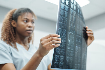 Hand of young African female radiologist in uniform analyzing x-ray image