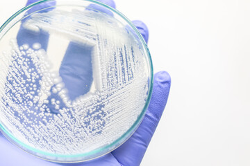 Pichia is a genus of yeasts in the family Saccharomycetaceae under the microscope for education.
