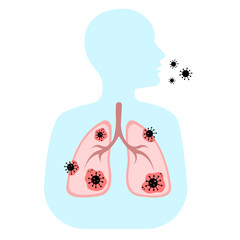 person infected with coronavirus, spread of covid-19, lungs affected by coronavirus
