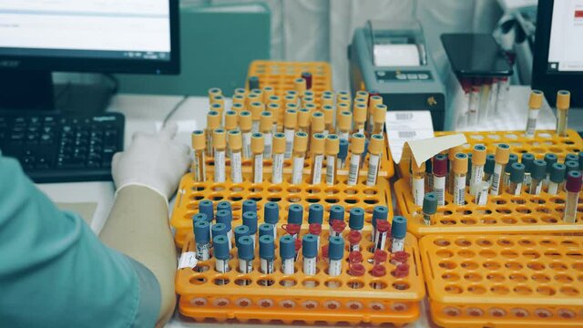 Many medical test tubes with blood tests on the table in the laboratory. The healthcare professional prints and signs labels for test tubes
