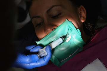 The dentist uses a blue gel to treat the patient's tooth. A woman at a dentist's appointment, a dentist uses a rubber dam and dental tools for treatment.