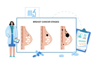 Breast disease concept
