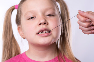 Pulling out a milk tooth with a thread from a little girl