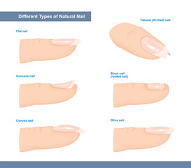 Different Types of Fingernail. Normal, Short, Roofed, Tubular, Arched, Flat, Convex and Concave Nails. Nail Extension Guide. Vector Illustration