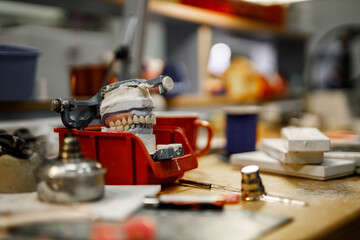 Dental office. Model on a table in prosthetic laboratory.