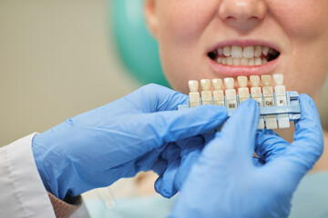 Close-up of woman choosing the implants during her visit at dentist's office