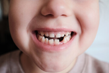 large mouth of a child without a tooth. First fallen tooth. The tooth fairy