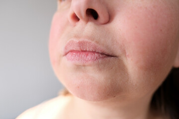 lips, mouth and chin of a middle-aged woman, part of the face close-up, fine wrinkles on the face, spots, cosmetology, plastic surgery and beauty concept