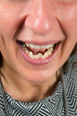 Close up of healthy teeth of young woman. Dental health care. Hygiene teeth. Dentistry