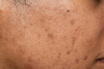 Dark spots and skin problems and itching Skin disease freckles on the skin
