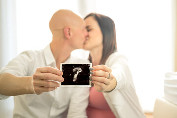 A young couple kisses happy to show the ultrasound of their baby - Husband and wife happy to have found out they are pregnant