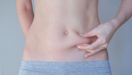 
Correction of the navel after childbirth