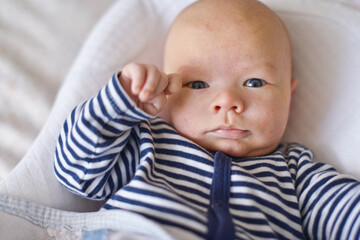 newborn with baby rash