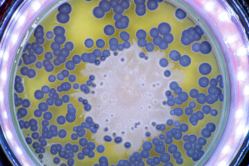 Growth  of bacteria and mold in a petri dish