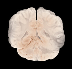 Vertical Section Through Cerebral Hemispheres. Human Brain Anatomy