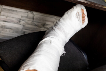 Leg in bandage fixed after bone broken.