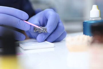 Applying the adhesive composition to new braces.Installation of braces for alignment of the dentition or bite. Unrecognizable person. Hands in protective gloves. The concept of health.