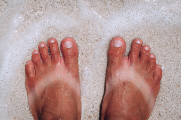 suntanned human feet with stripes of white skin from sandals in summer standing on the sand and sea waves