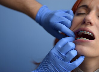 Doctor examines the brackets of the woman's mouth on a blue background.