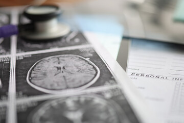 On table is photograph with results of brain examination.