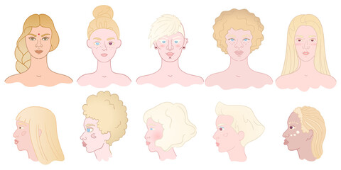 Fototapeta premium Hand drawn set of albino women portraits - front and side view. Diversity young girls with albinism. Albinism is genetic disease when decrease of melanin cause white skin and hair