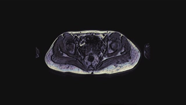 Bulk multicolored MRI of the female pelvic organs, abdominal cavity, gastrointestinal tract and bladder