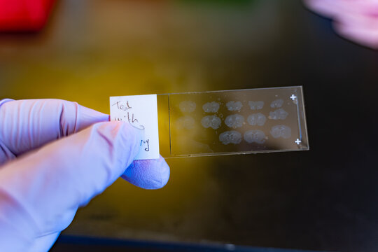 scientist holding a microscope slide with mouse brain slices
