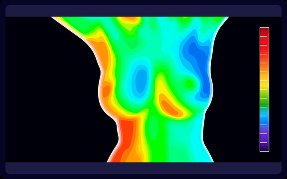 Vector graphic of Thermographic image of breast on black background. Woman's chest showing different temperatures in range of colors from blue showing cold to red showing hot. vector eps10.