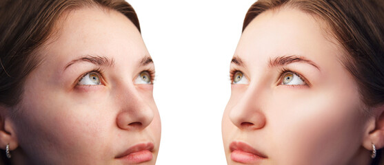 Face of beautiful woman before and after skin retouch. Beautician concept.