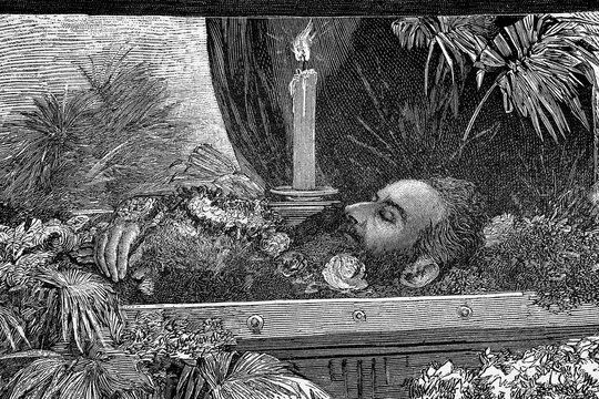 Hans Makart in his deathbed. Austrian painter, draughtsman, designer and decorator. 1840-1884. Antique illustration. 1884.