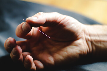 close up of a hand holding an acupuncture needle - obrazy, fototapety, plakaty