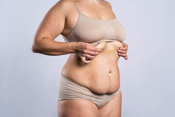 Tummy tuck, flabby skin on a fat belly, plastic surgery concept