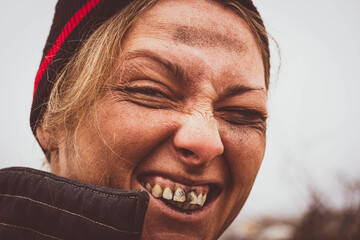 Close-up of a dirty woman's face. A dirty bum smiles and shows black teeth on the background of a...