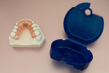Zahnspange Kieferorthopädie Zahn