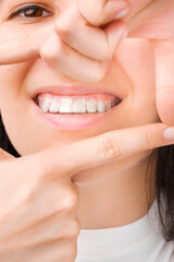 Smiling woman in clear and invisible aligners making a frame by hands. 