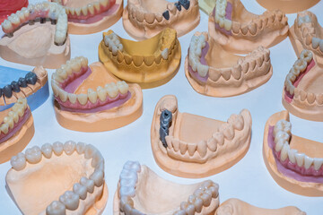 Dental concept. Models of human jaws on a white table. Elimination of dental problems. Dental treatment and prosthetics. Treatment of various teethes pathologies.