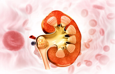 human kidney, kidney stone, anatomy. 3d illustration..