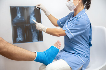Bone fracture foot and leg on male patient being examined by a woman doctor in a hospital.