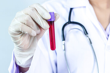 A lab assistant is picking up an experimental blood vessel in a laboratory.