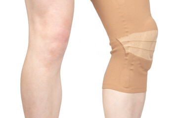 bandage for fixing the injured knee of the leg. medicine and sports. limb injury treatment