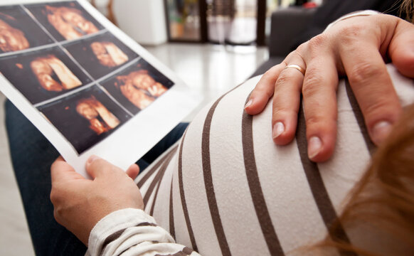 The pregnant woman is looking on the photo of her child making by ultrasound