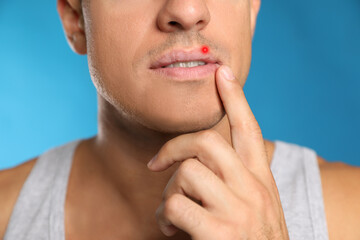 Obraz premium Man with herpes touching lip against light blue background, closeup