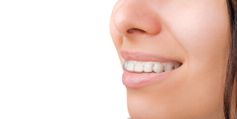 A side view of a womans smile in transparent and removable aligners with copy space.